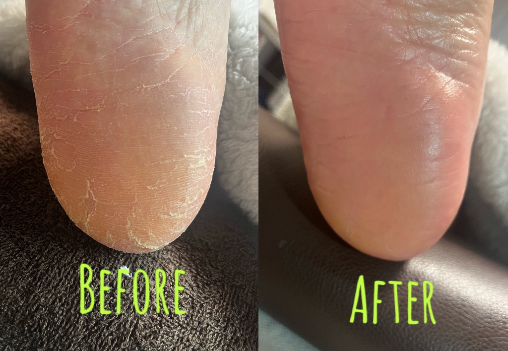 秋冬のフットケアはじめどき♪